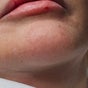 CharLuxe Aesthetics
