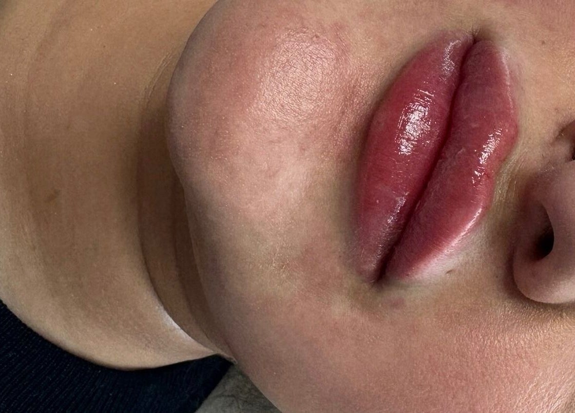 Glossy lips post-treatment at Aesthetics & Beauty By Rochelle in Croydon, England, GB for a radiant look.