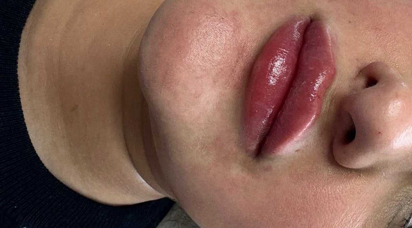 Glossy lips post-treatment at Aesthetics & Beauty By Rochelle in Croydon, England, GB for a radiant look.