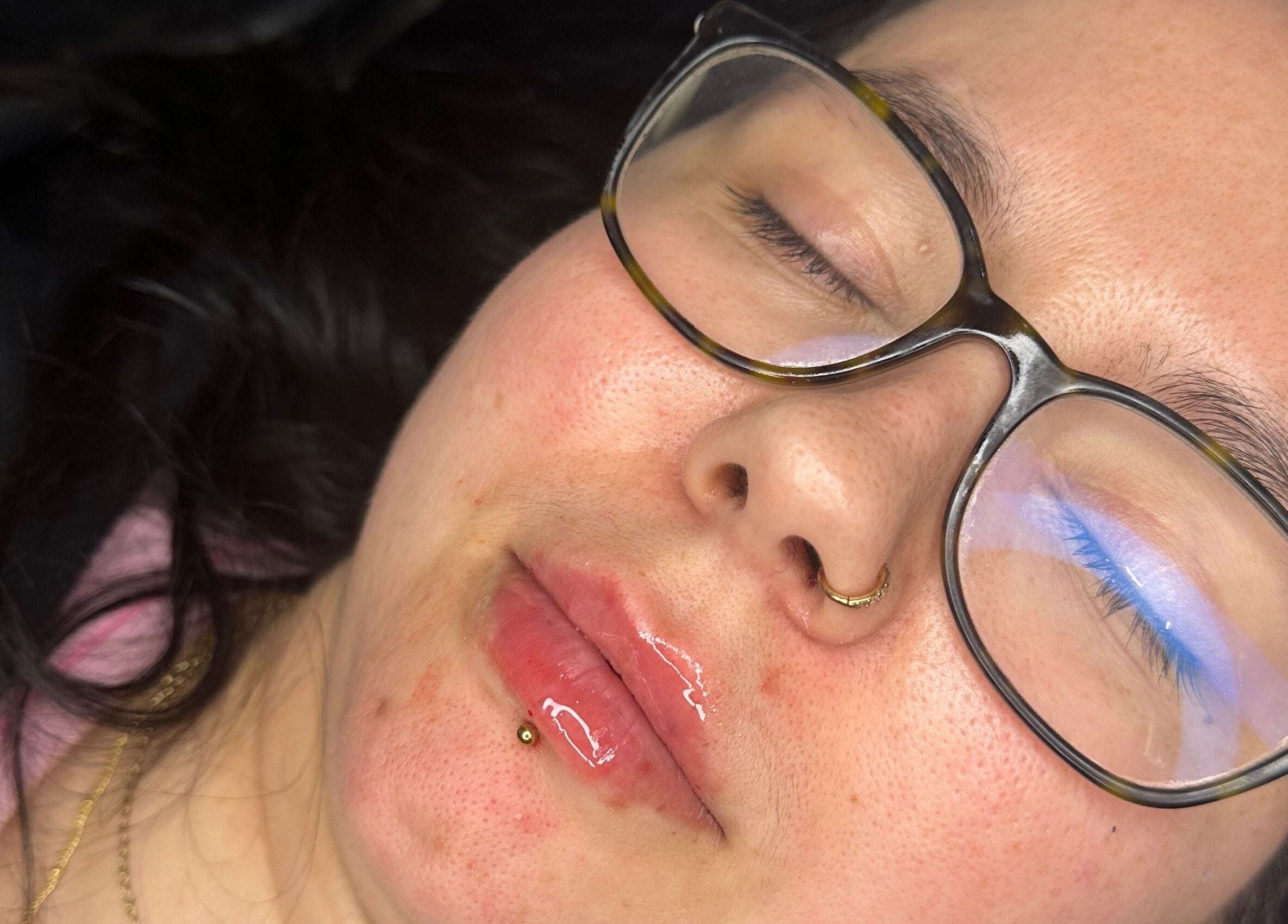 Relaxed client at Aesthetics & Beauty By Rochelle, lip treatment in Croydon, England, GB.