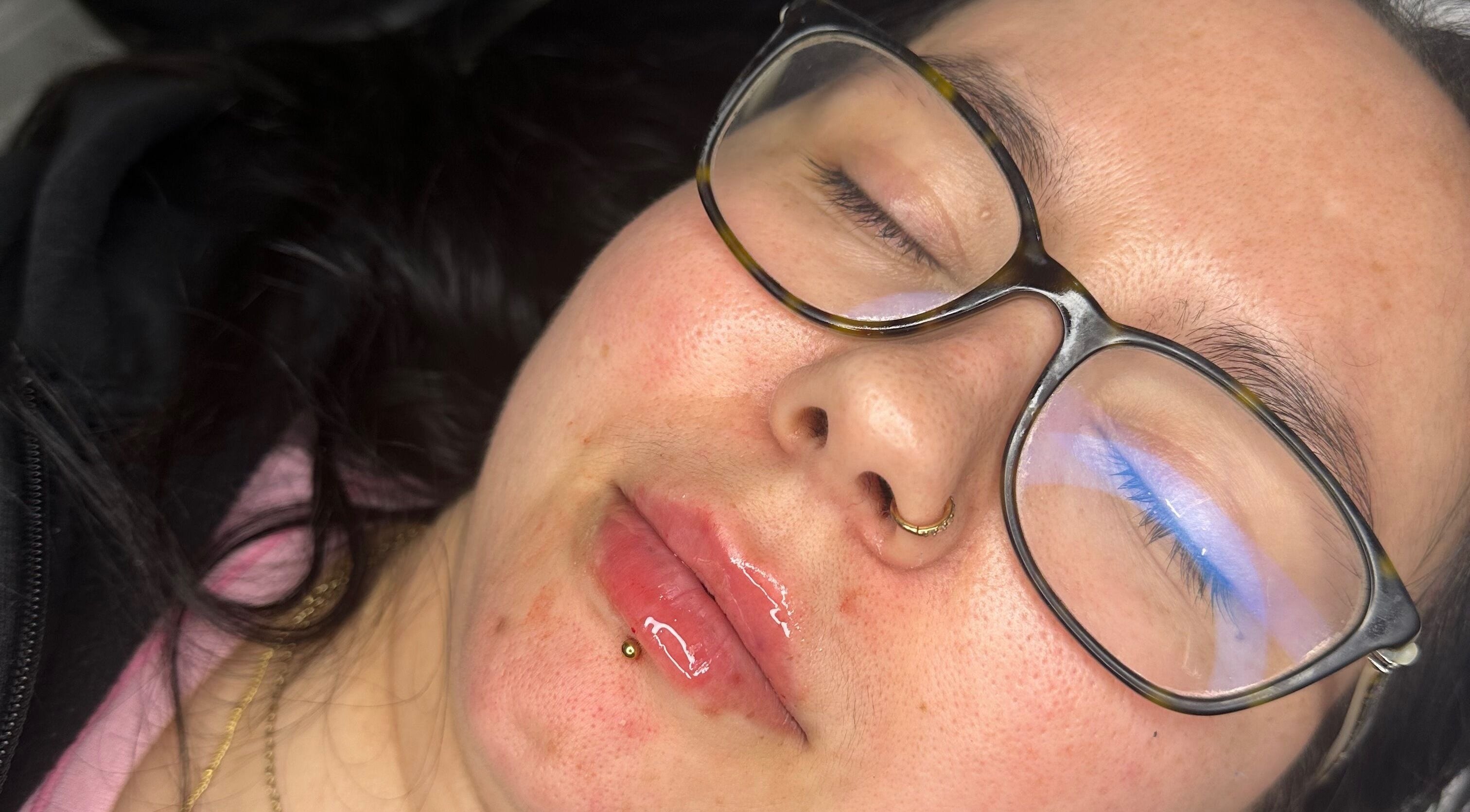 Relaxed client at Aesthetics & Beauty By Rochelle, lip treatment in Croydon, England, GB.