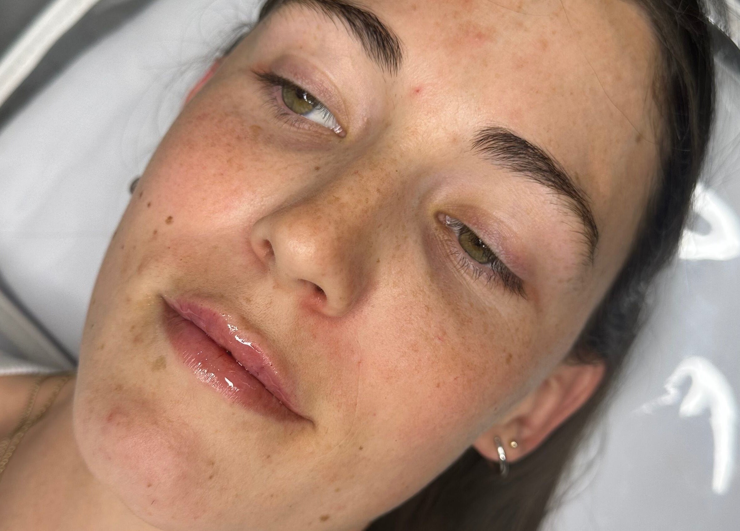 Close-up of a client's rejuvenated skin at Aesthetics & Beauty By Rochelle, Croydon, England, GB.