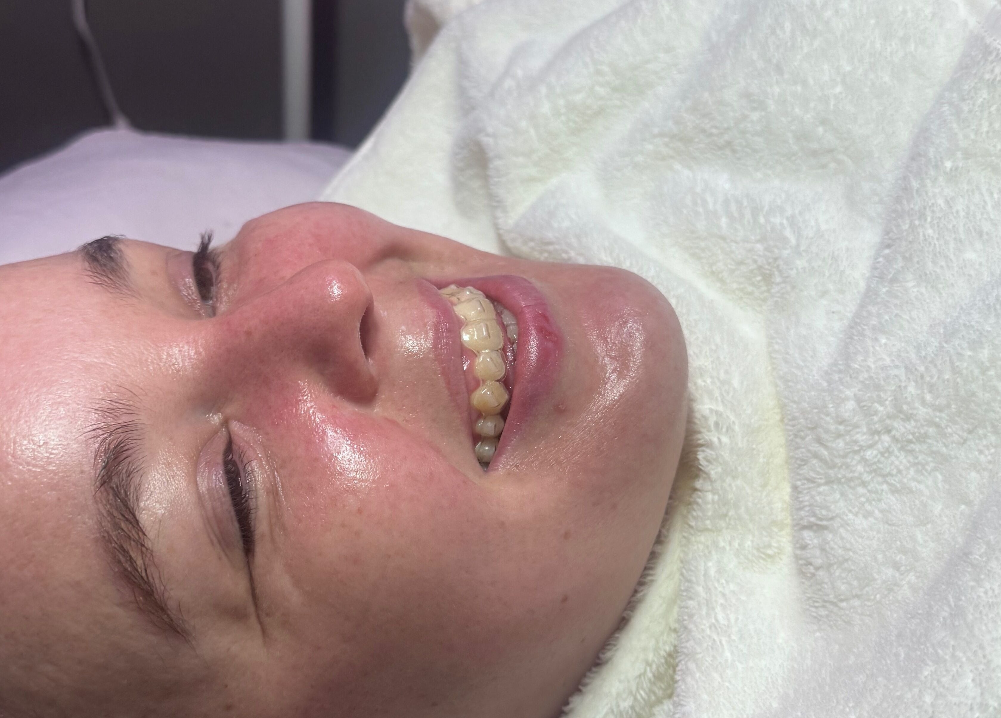 A relaxed client with glowing skin after a facial at Aesthetics & Beauty By Rochelle, Croydon, England, GB.