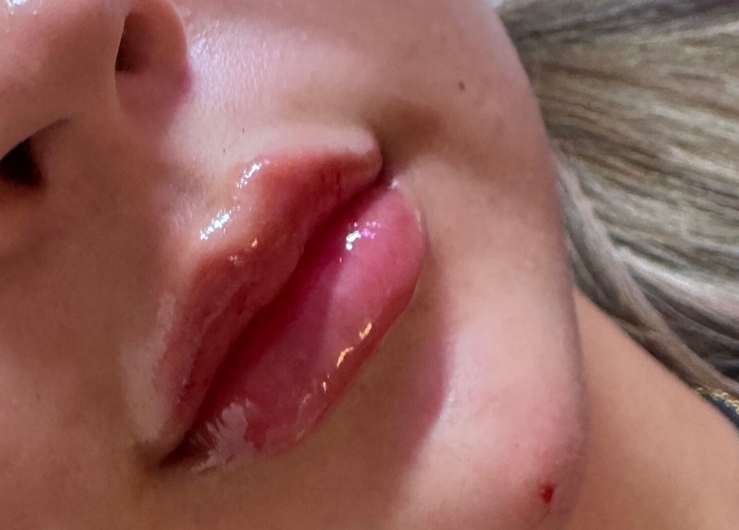 Close-up of glossy lips after treatment at Aesthetics & Beauty By Rochelle, Croydon, England, GB.