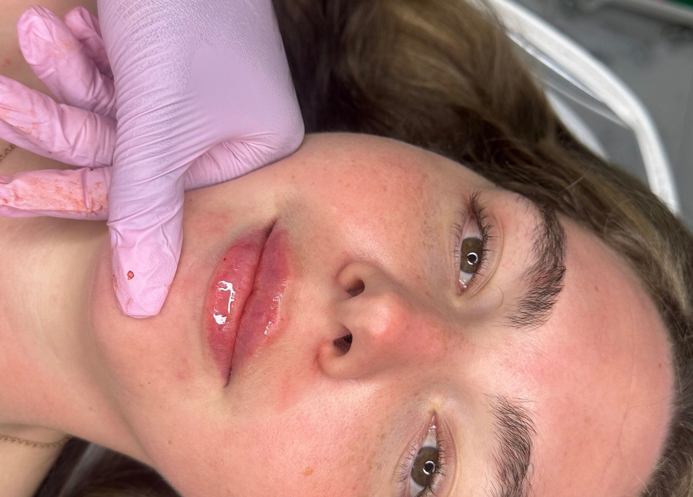 Close-up of lip treatment at Aesthetics & Beauty By Rochelle, Croydon, England, GB.