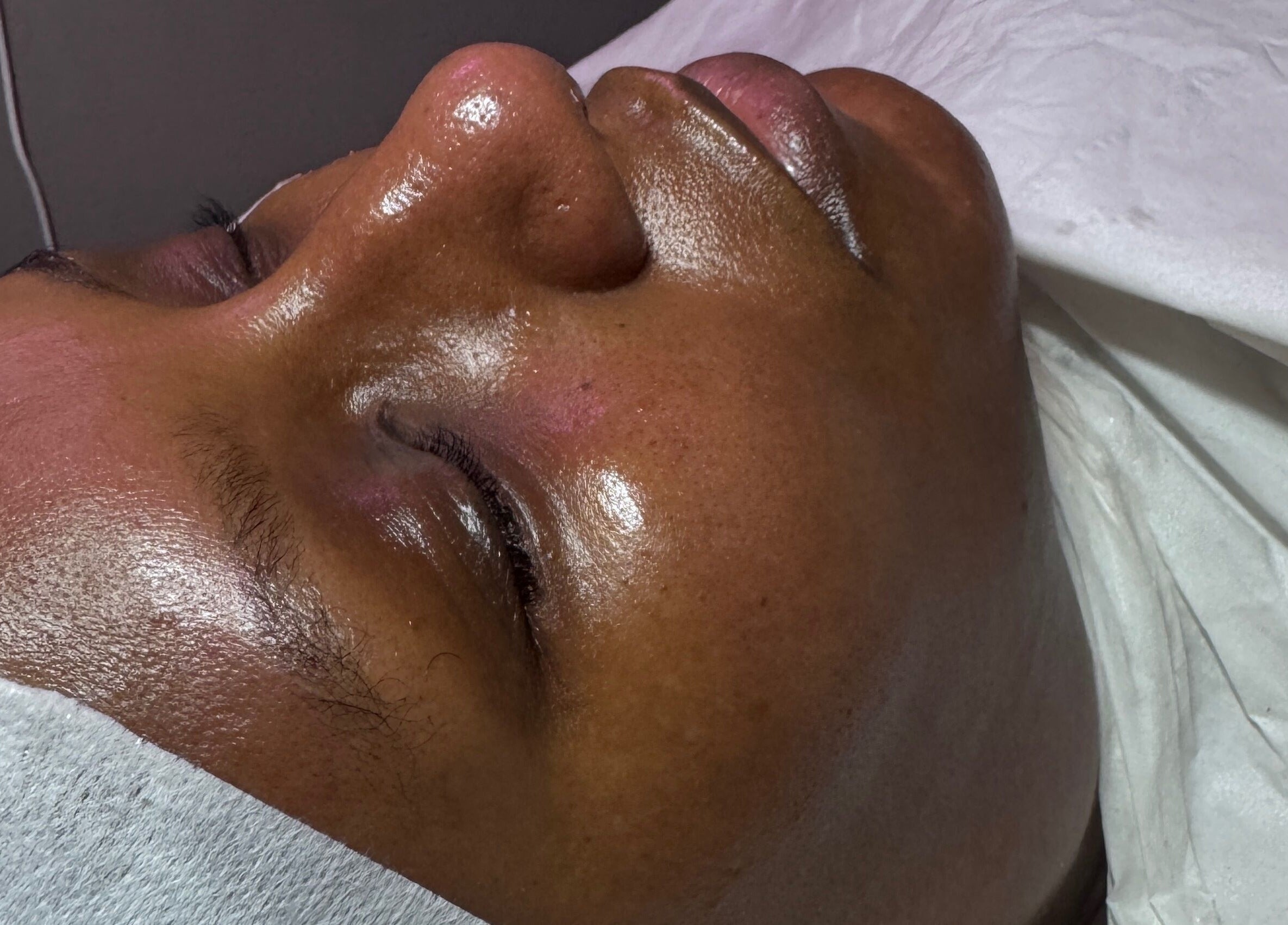 Close-up of a facial treatment at Aesthetics & Beauty By Rochelle, Croydon, England, GB.