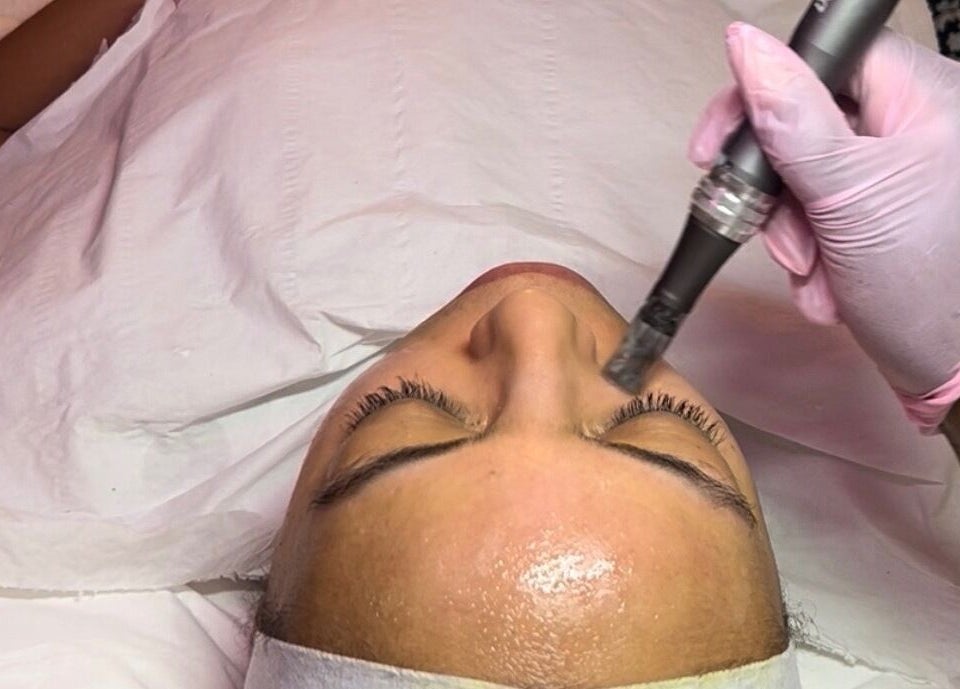 Close-up of facial treatment at Aesthetics & Beauty By Rochelle, Croydon, England, GB.