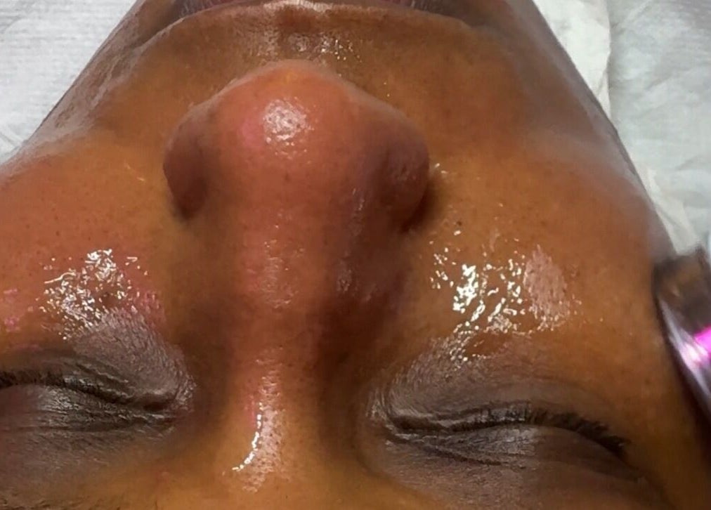 Close-up of a facial treatment at Aesthetics & Beauty By Rochelle, Croydon, England, GB enhancing skin radiance.