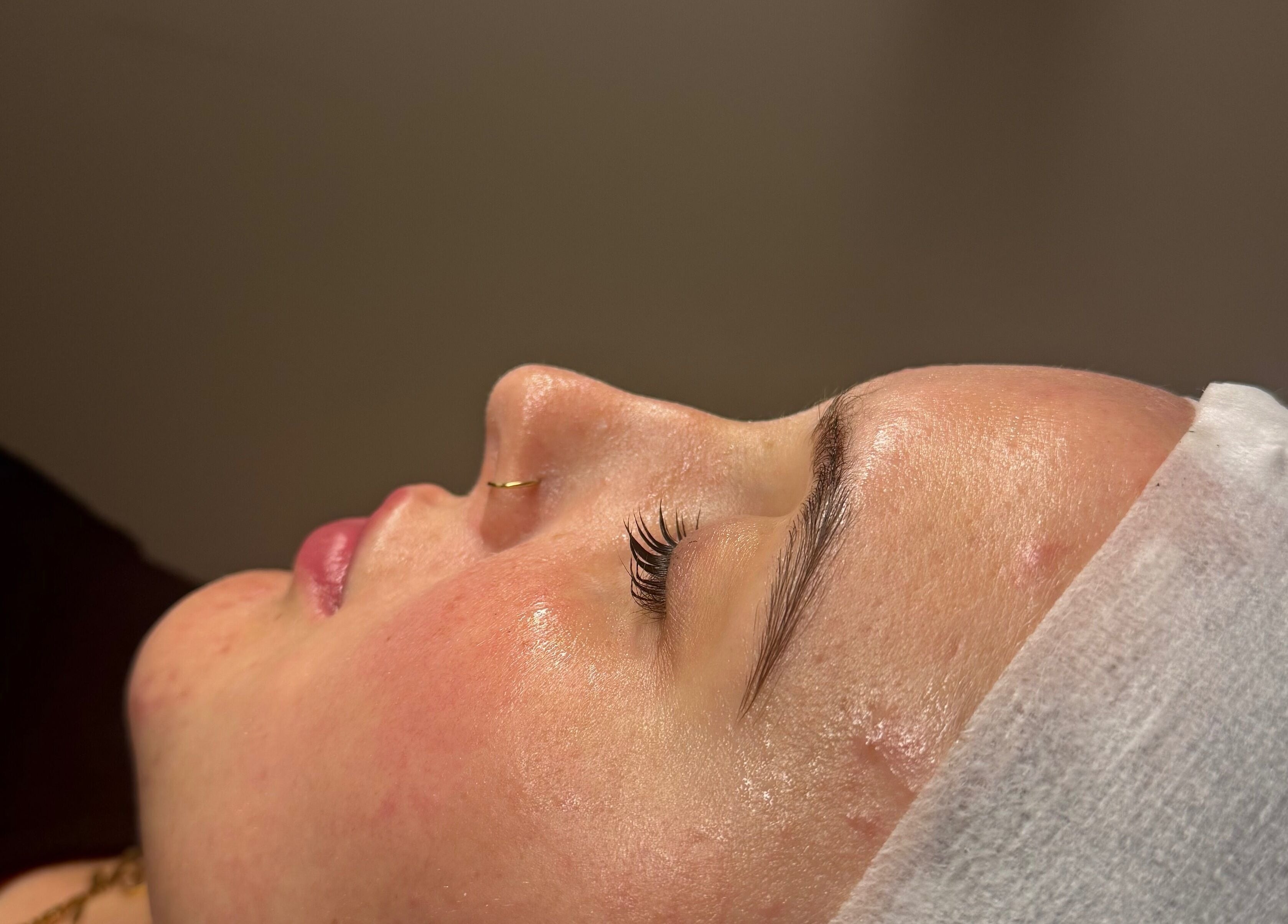 Close-up of a serene face with glowing skin at Afterglow Beauty Ltd, Goole, England, GB.