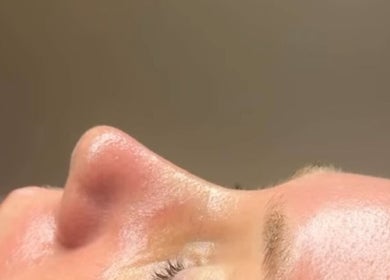 Close-up of a glowing face receiving beauty treatment at Afterglow Beauty Ltd, Goole, England, GB.