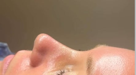 Close-up of a glowing face receiving beauty treatment at Afterglow Beauty Ltd, Goole, England, GB.