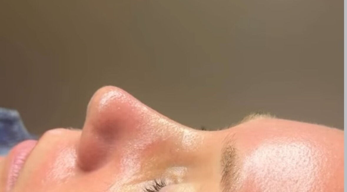 Close-up of a glowing face receiving beauty treatment at Afterglow Beauty Ltd, Goole, England, GB.