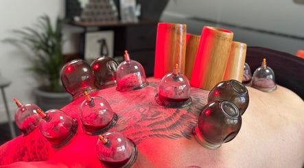 Cupping therapy session at Momentum ST, Birmingham, England, GB with bamboo cups and red lighting.