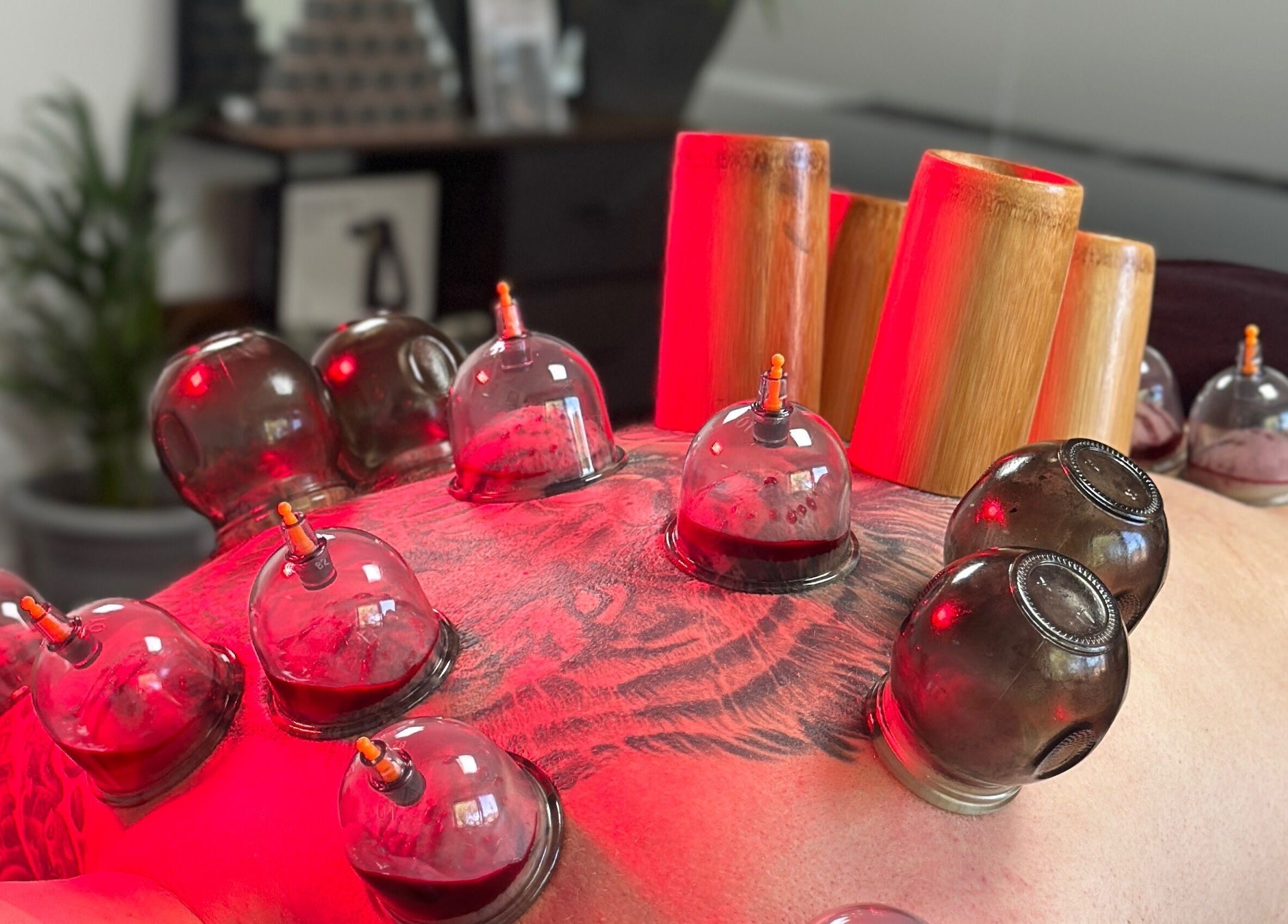 Cupping therapy session at Momentum ST, Birmingham, England, GB. Red cups on back offering wellness benefits.