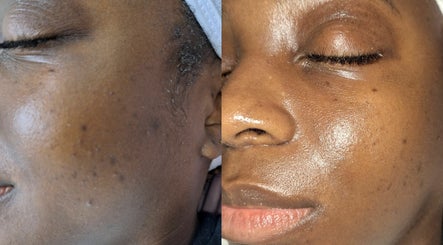 Ubuhle Skin Care imagem 2