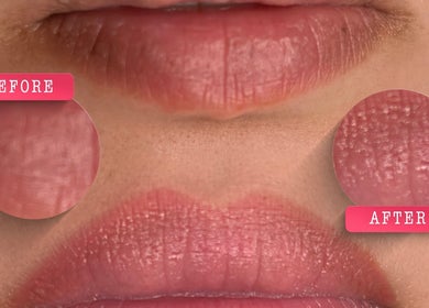 Lip treatment before and after at Aroma Beauty Palace, Cashmere, Queensland, AU; shows improved texture.