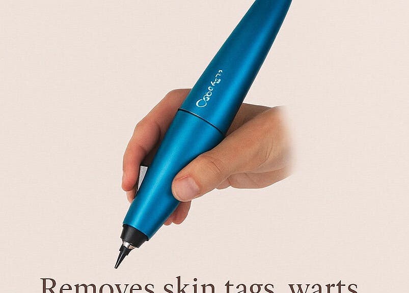 Skin tag removal pen used at Fran Wainwright Beauty & Aesthetics, Inspire Longtown, Carlisle, England, GB.