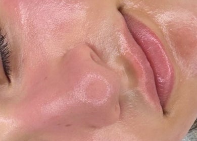 Close-up of a glowing facial treatment at The Skin Dollhouse, Bradford, England, GB.