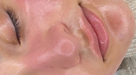 Close-up of a glowing facial treatment at The Skin Dollhouse, Bradford, England, GB.