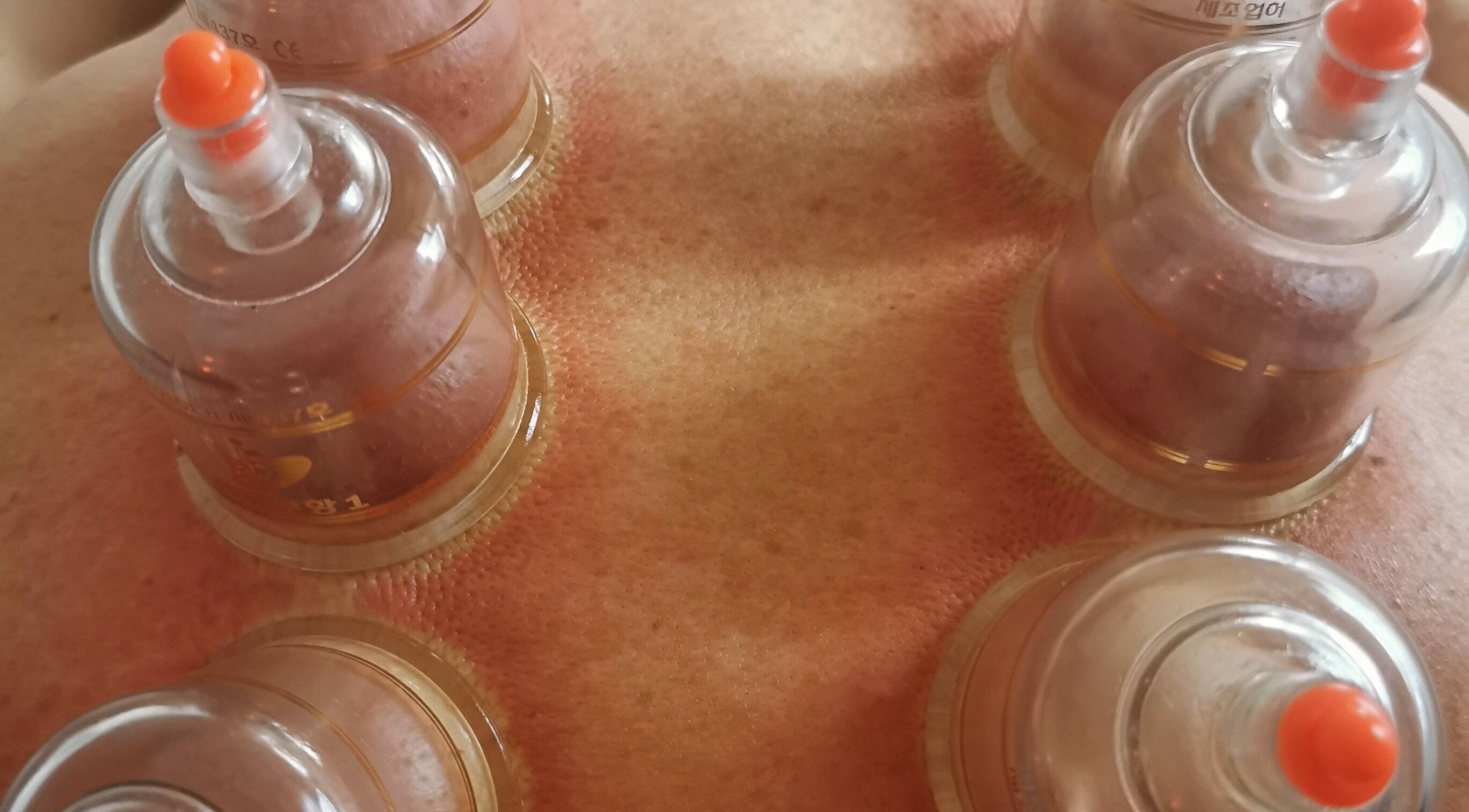 Eivissa Wellbeing in Lancaster, England offers cupping therapy for holistic healing experiences.