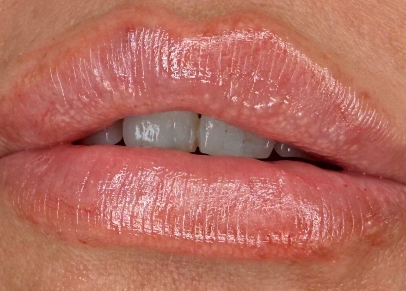 Close-up of glossy lips showcasing beauty treatment at AB Beauty, Newton Abbot, England, GB.