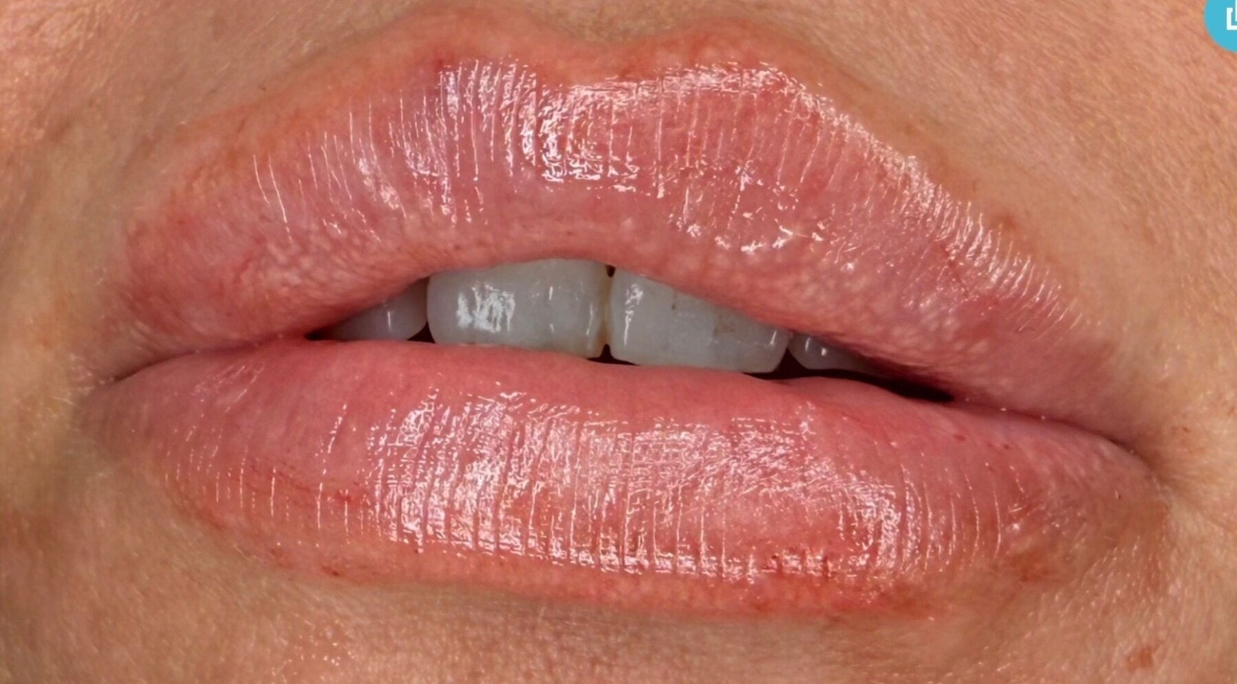 Close-up of glossy lips showcasing beauty treatment at AB Beauty, Newton Abbot, England, GB.
