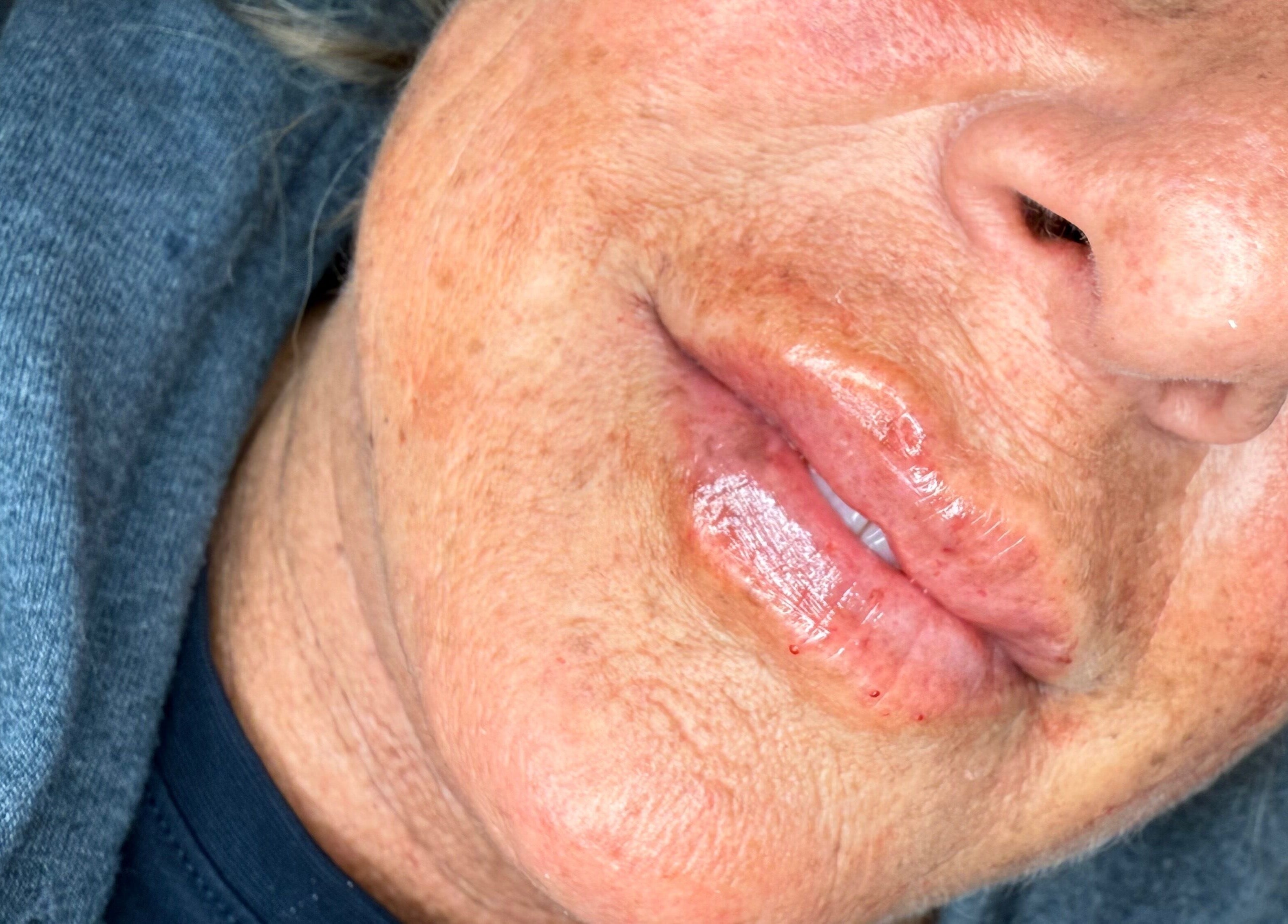 Close-up of a person's lips showcasing a beauty treatment at AB Beauty, Newton Abbot, England, GB.