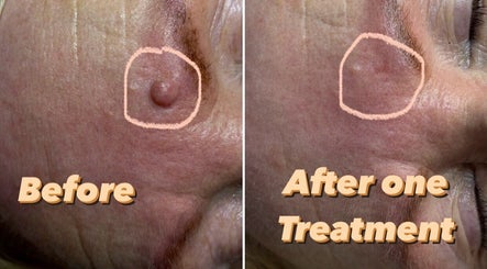 Skin Bliss Advanced Beauty based at Hestia