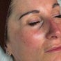 Skin Bliss Advanced Beauty Based at Hestia