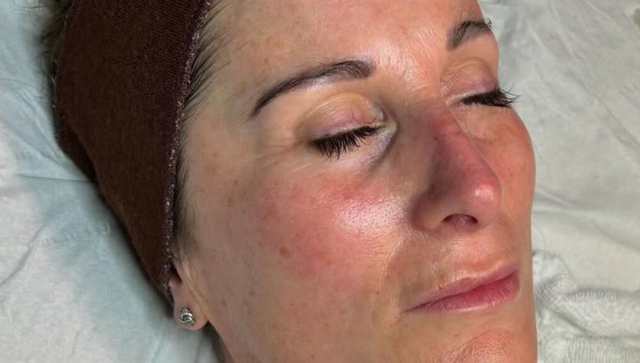 Skin Bliss Advanced Beauty Based at Hestia image 1