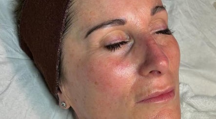 Skin Bliss Advanced Beauty Based at Hestia