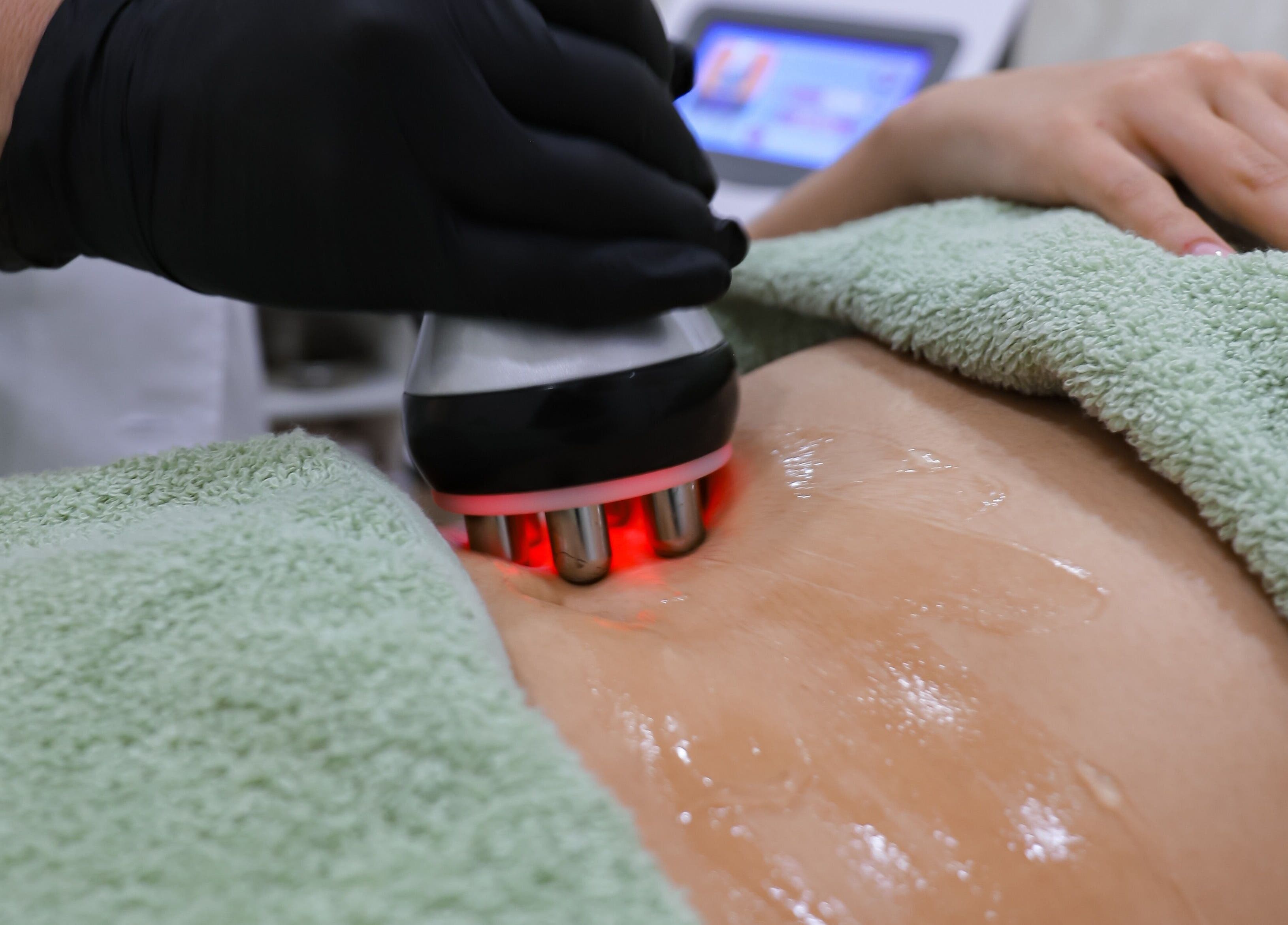 Tratamento estético no abdômen em JORA Aesthetics | Clinic & Academy em Braga, Braga, PT.