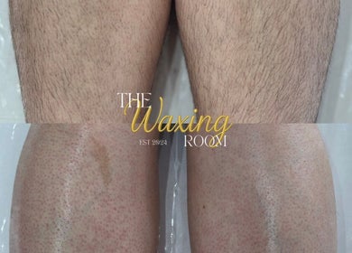 Before and after leg waxing at The Waxing Room, Pencoed, Wales, GB, showcasing smooth skin results.