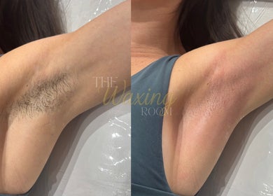 Before and after waxing transformation at The Waxing Room, Pencoed, Wales, GB.
