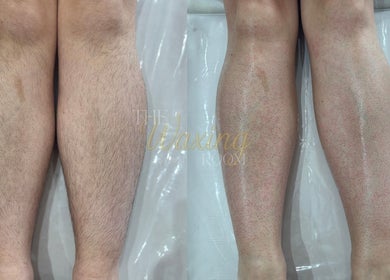 Before and after leg waxing at The Waxing Room, Pencoed, Wales, GB, showcasing hair removal results.
