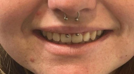 Charm'Elles Piercing et strass dentaire