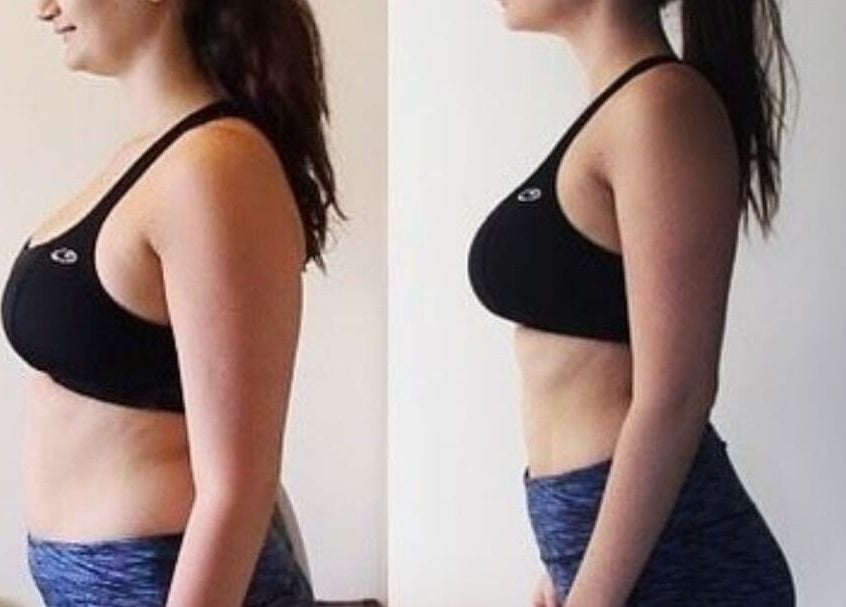 Antes y después de transformación corporal en Coral&Co. Estudio ccp, Concepción, Bío Bío, CL.