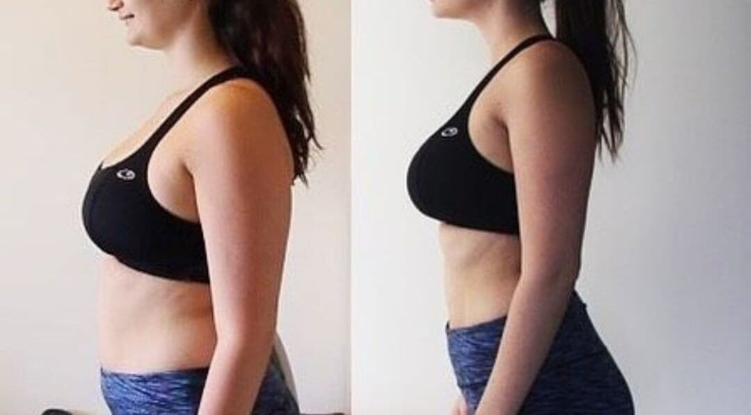 Antes y después de transformación corporal en Coral&Co. Estudio ccp, Concepción, Bío Bío, CL.