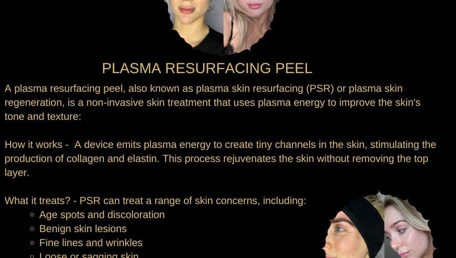 Plasma Resurfacing Peel at Skintelligence by Olivia Rose Louise, York, England. Non-invasive skin rejuvenation.