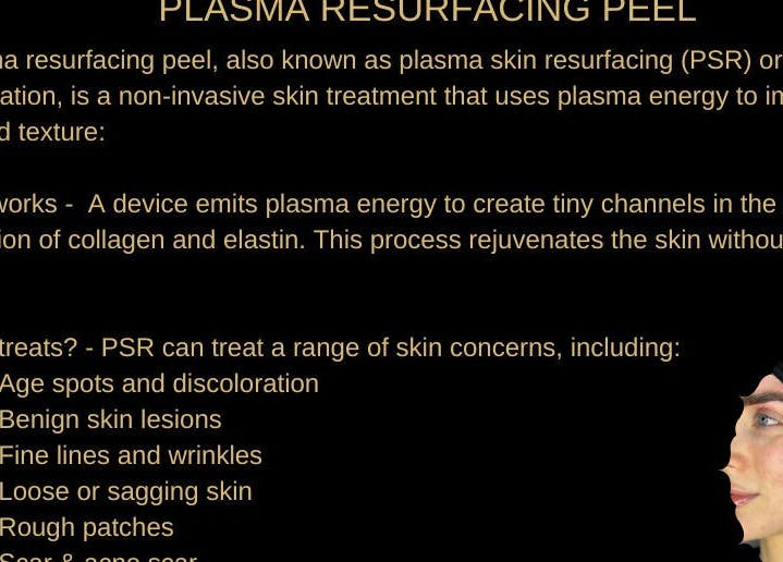 Plasma resurfacing peel treatment details at Skintelligence by Olivia Rose Louise, York, England, GB.