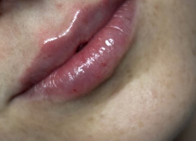 Close-up of glossy lips at Angelic Aesthetics and Cosmetics, Canterbury, England, GB, showcasing a smooth finish.