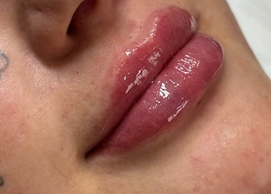 Enhance your natural beauty at Angelic Aesthetics and Cosmetics in Canterbury, England, GB with our lip treatments.