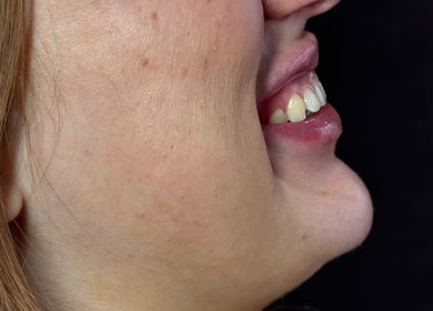 Close-up of a smiling profile with glowing skin at Angelic Aesthetics and Cosmetics, Canterbury, England, GB.