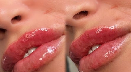 LM Aesthetics & beauty