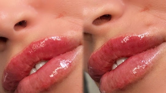 LM Aesthetics & beauty
