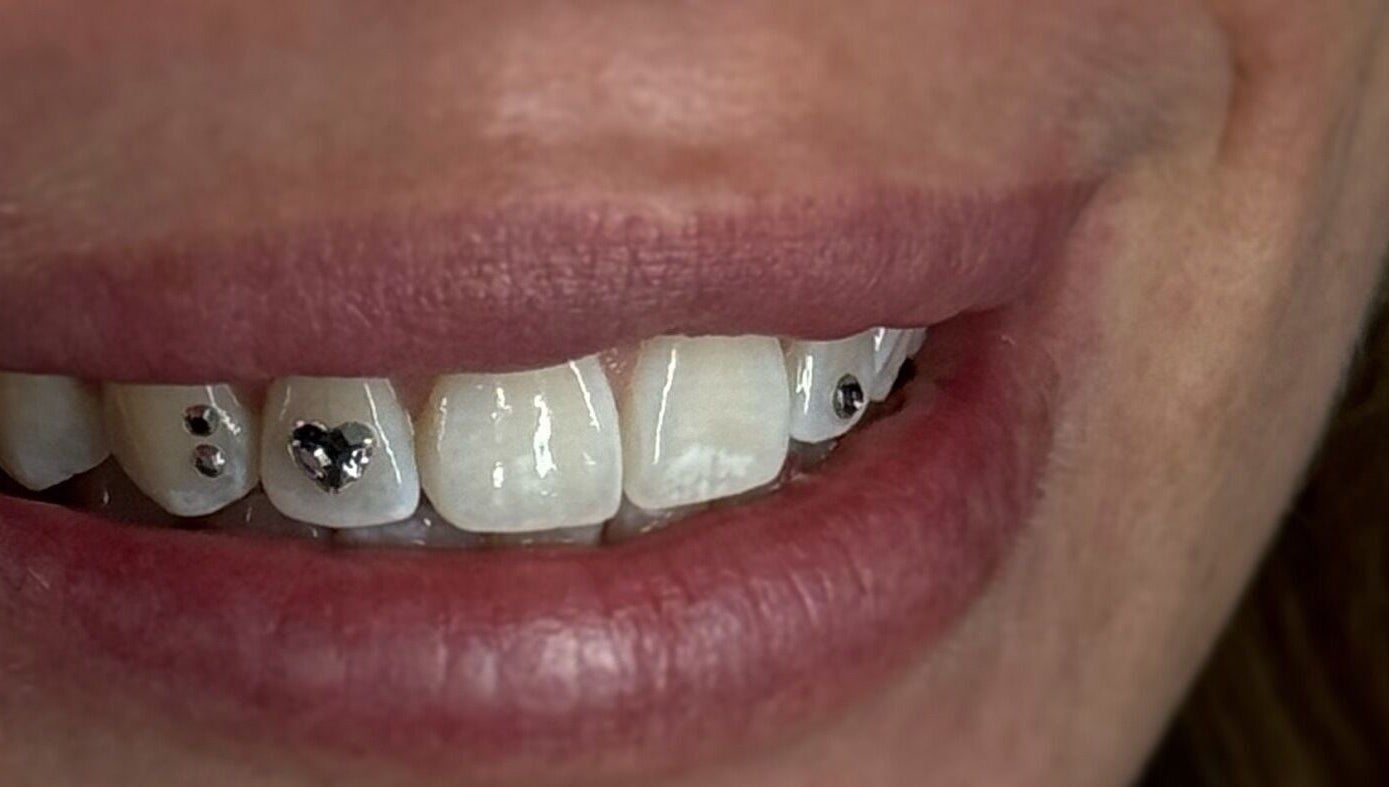 Elegant tooth jewelry at ChromeFangStudio & Northernfangs // North Shields, North Tyneside, England, GB.