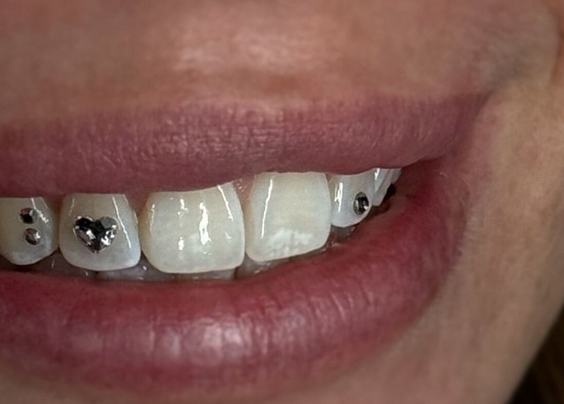 Elegant tooth jewelry at ChromeFangStudio & Northernfangs // North Shields, North Tyneside, England, GB.