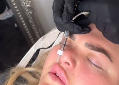 Botox treatment at Cupids Glow, Bolton, England, GB enhancing client's forehead beauty and rejuvenation.