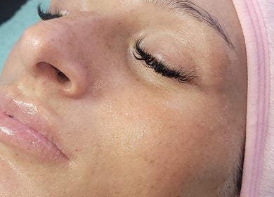 Relaxed face after treatment at Cupids Glow, Bolton, England, GB. Experience rejuvenating beauty services.