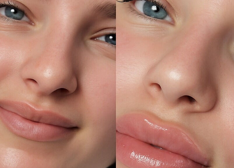 Close-up before and after lip treatment at Cupids Glow, Bolton, England, GB, showcasing enhanced lips.